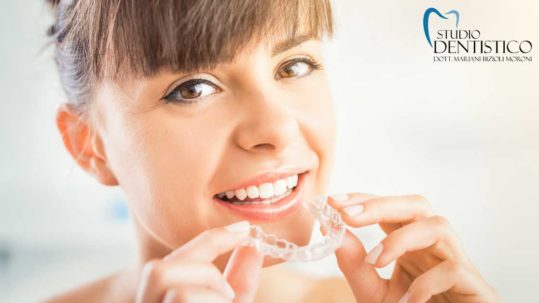 Ortodonzia invisibile a Fiorano al Serio | Studio Dentistico MBM